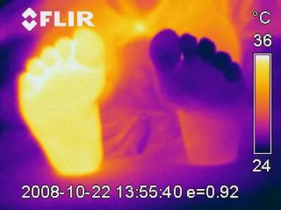 Thermographie im Zentrum für Schmerzmedizin